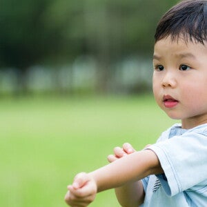 Preventing childhood allergies: is it possible?