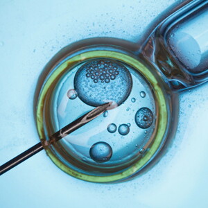 IVF Treatment: Everything You Need to Know