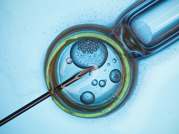 IVF Treatment: Everything You Need to Know